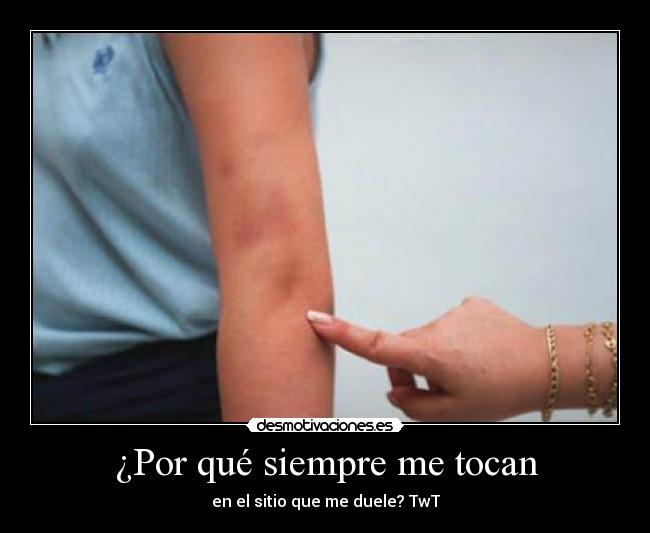 ¿Por qué siempre me tocan - en el sitio que me duele? TwT