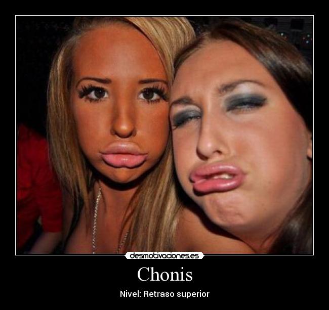 Chonis - Nivel: Retraso superior