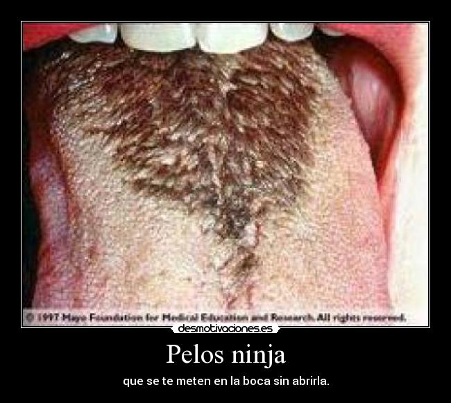 Pelos ninja -