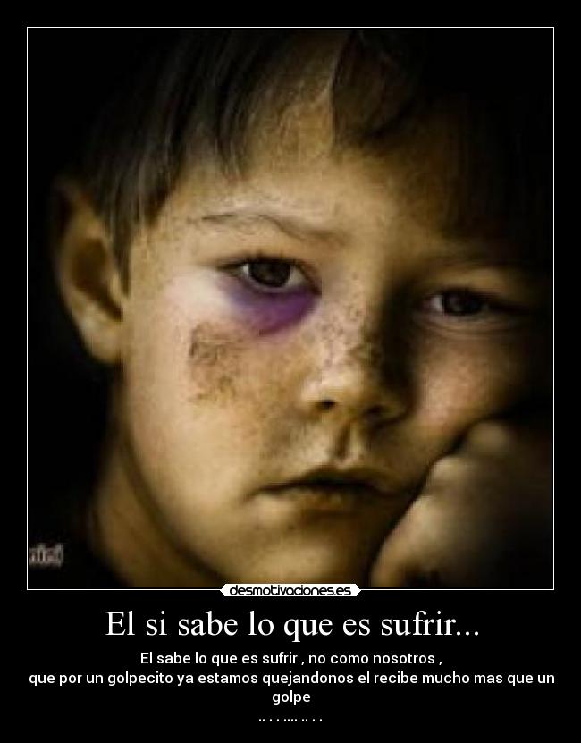 El si sabe lo que es sufrir... - El sabe lo que es sufrir , no como nosotros ,
que por un golpecito ya estamos quejandonos el recibe mucho mas que un golpe
.. . . .... .. . .