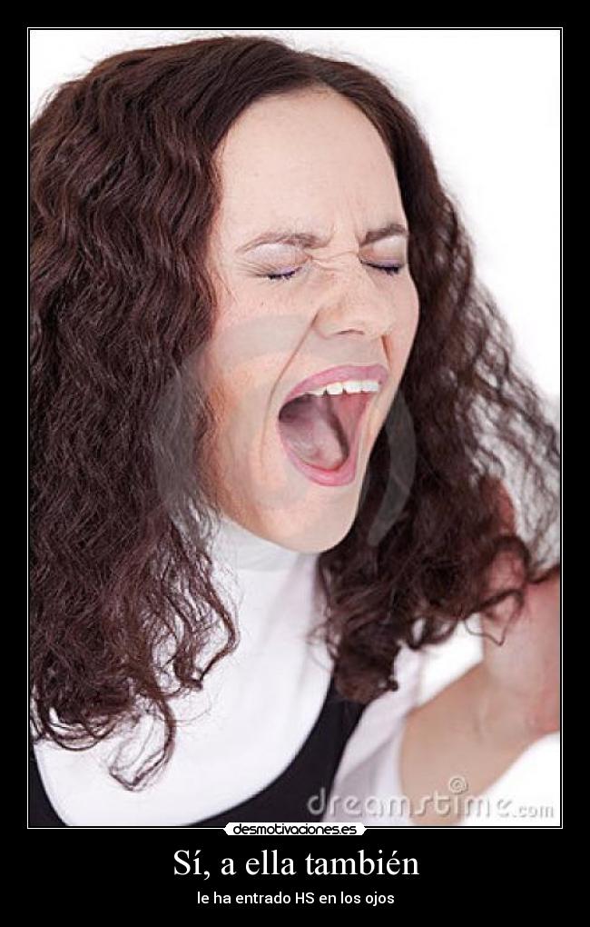Sí, a ella también -
