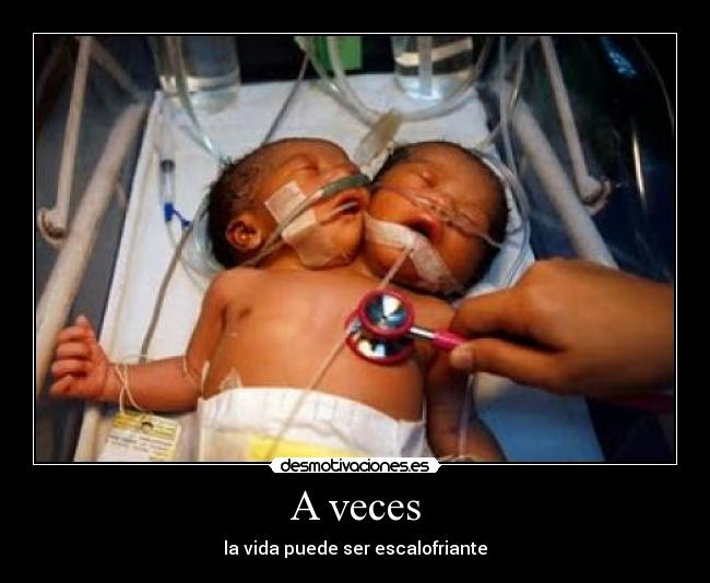 A veces -