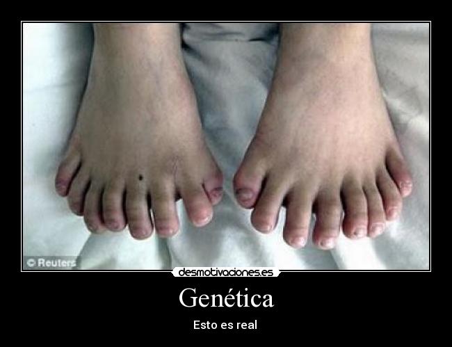 Genética -