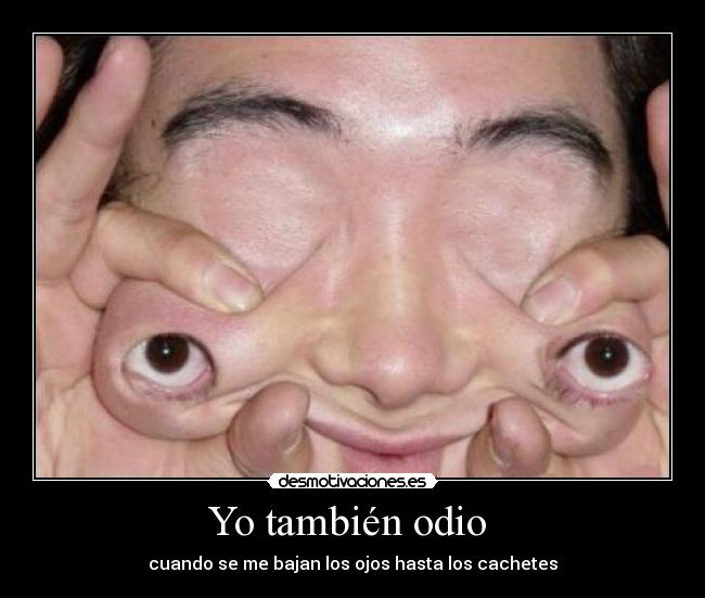 Yo también odio  - cuando se me bajan los ojos hasta los cachetes