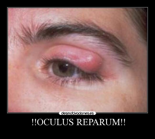 !!OCULUS REPARUM!! - 
