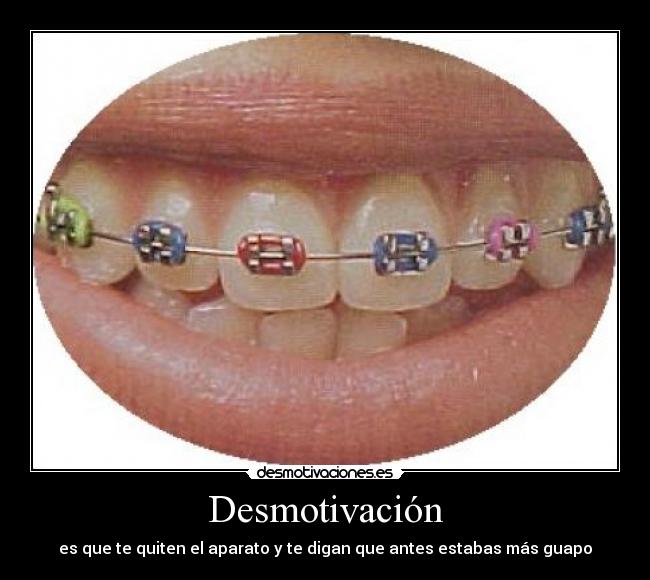 Desmotivación - es que te quiten el aparato y te digan que antes estabas más guapo