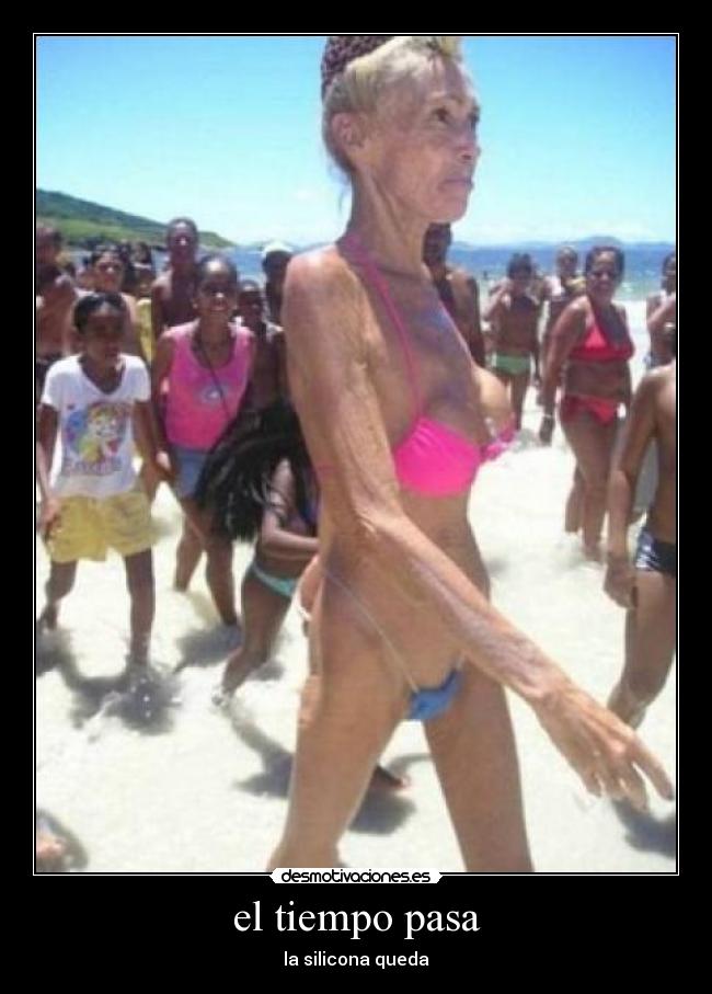 el tiempo pasa - la silicona queda