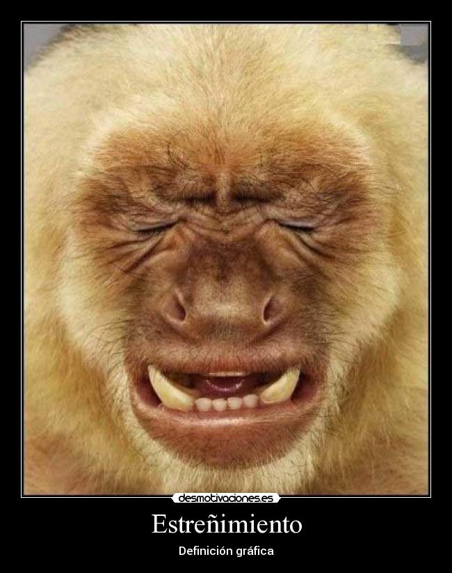 Estreñimiento - Definición gráfica