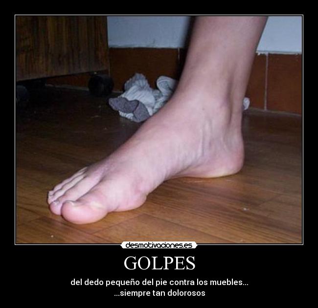 GOLPES - 