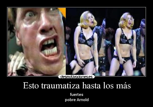 Esto traumatiza hasta los más - fuertes
pobre Arnold