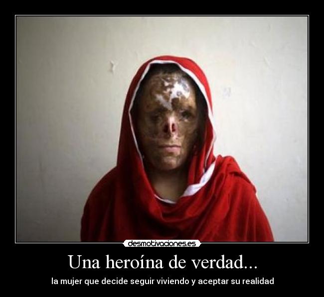 carteles mujer pakistan quemada acido exposicion fotografica verdad heroina desmotivaciones