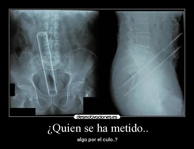 ¿Quien se ha metido.. - algo por el culo..?