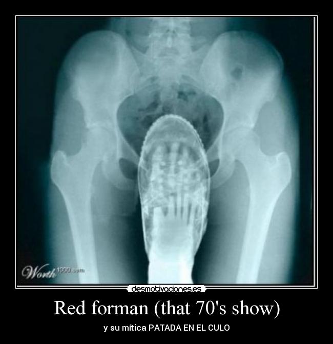 Red forman (that 70s show) - y su mítica PATADA EN EL CULO