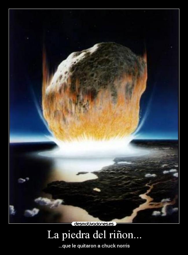 La piedra del riñon... -