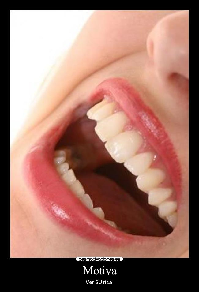 Motiva - Ver SU risa ♥