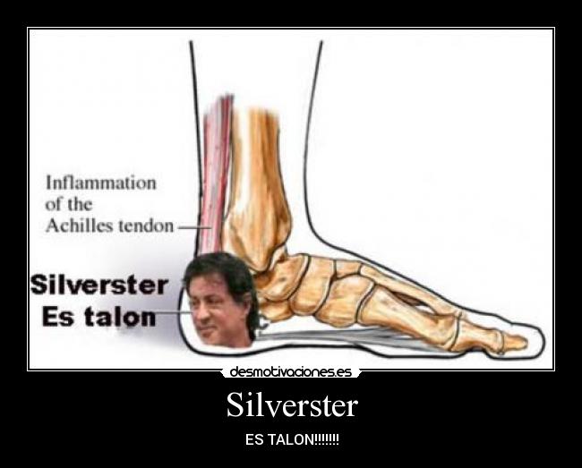 Silverster - ES TALON!!!!!!!