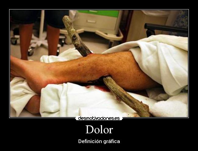 Dolor - Definición gráfica