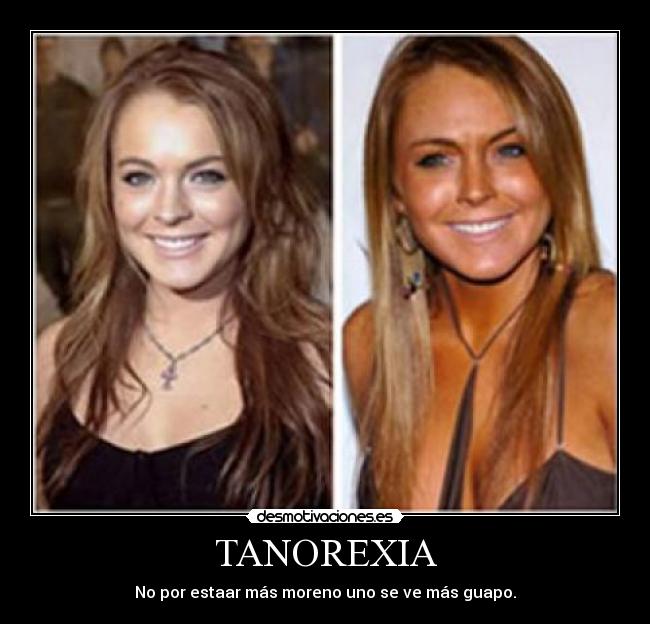 TANOREXIA - No por estaar más moreno uno se ve más guapo.