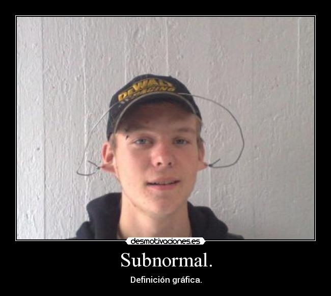 Subnormal. - Definición gráfica.