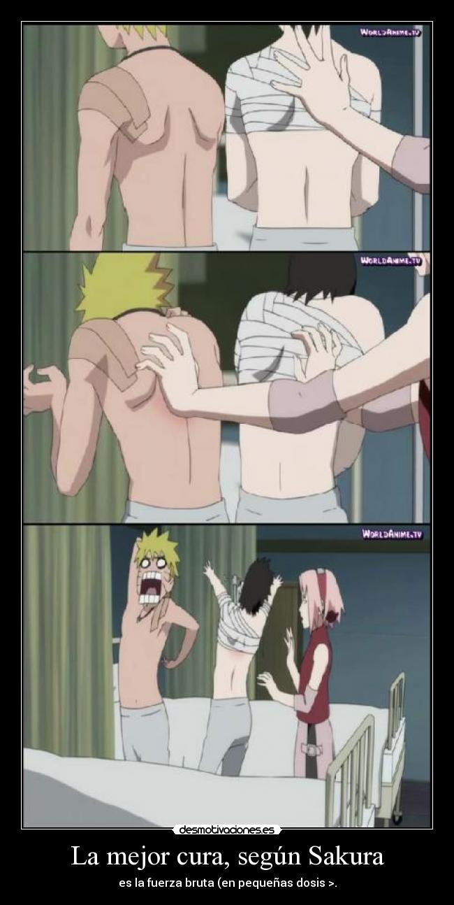La mejor cura, según Sakura - 