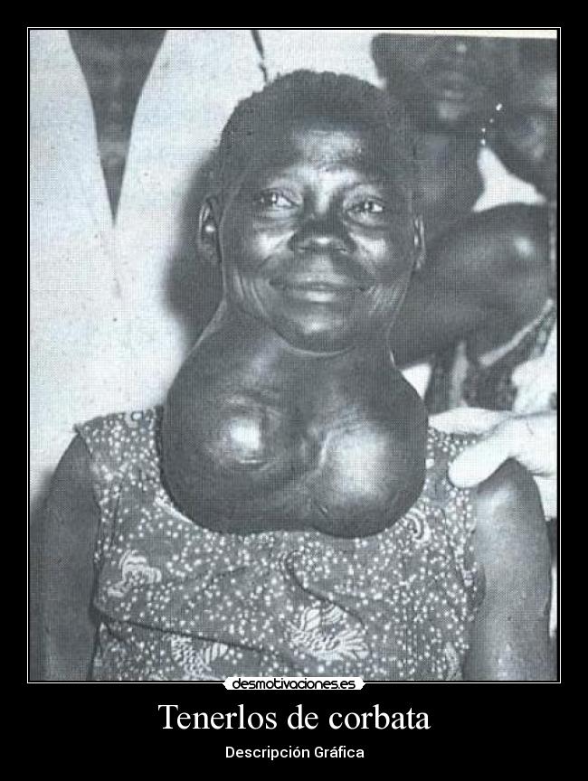 Tenerlos de corbata - Descripción Gráfica