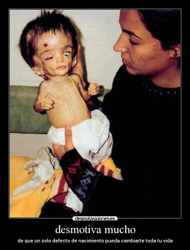 desmotiva mucho - de que un solo defecto de nacimiento pueda cambiarte toda tu vida