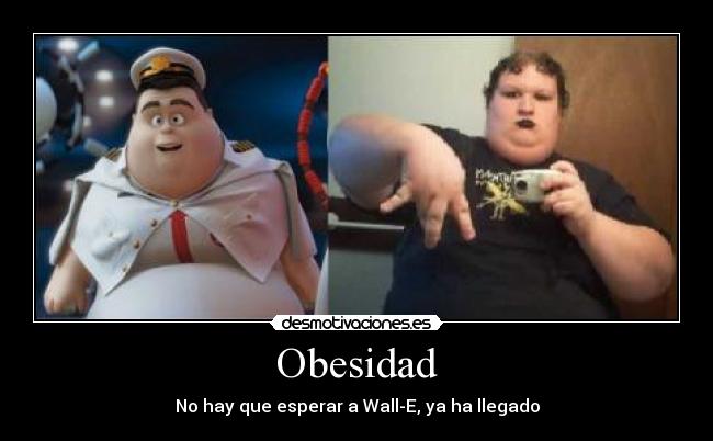 Obesidad - 