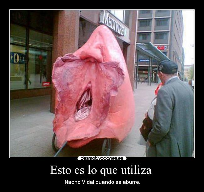 Esto es lo que utiliza  - 