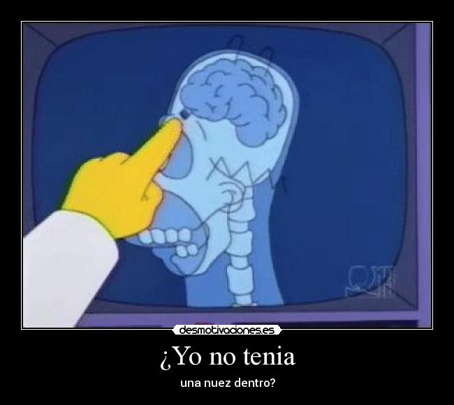 ¿Yo no tenia -