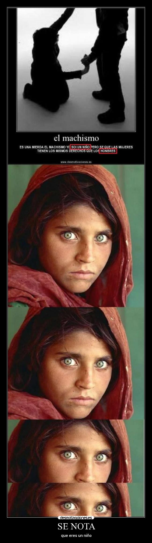 SE NOTA - que eres un niño