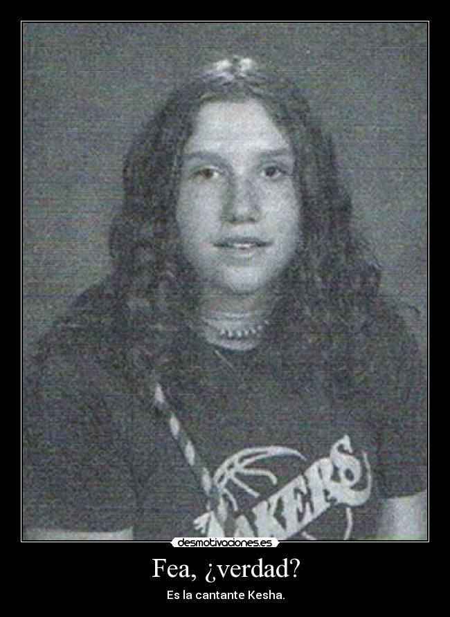 Fea, ¿verdad? - Es la cantante Kesha.
