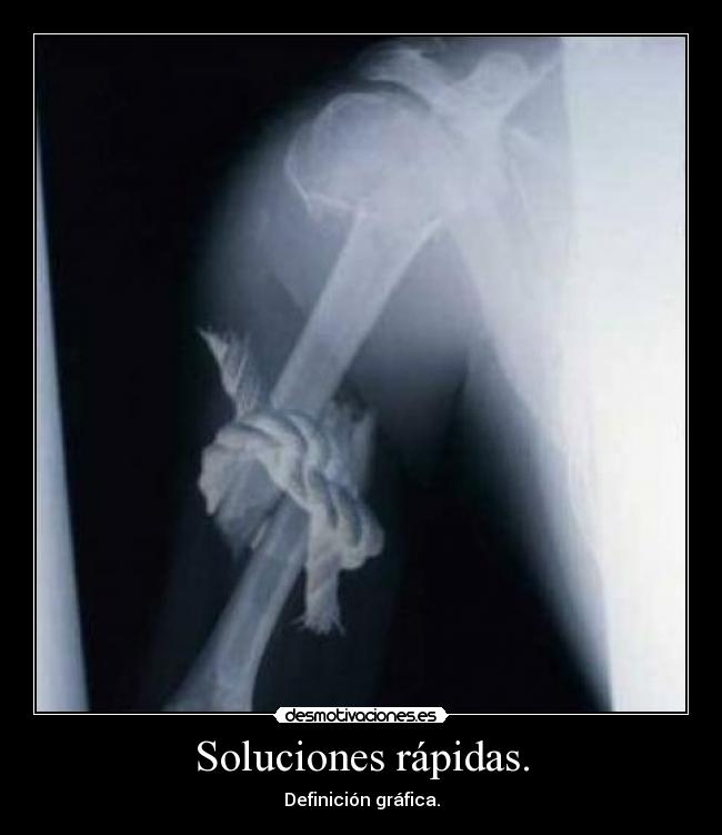 Soluciones rápidas. -