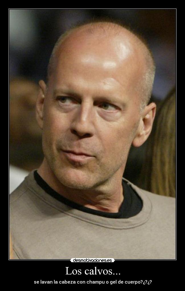 Los calvos... -