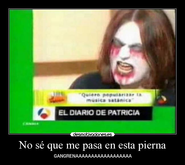 No sé que me pasa en esta pierna - GANGRENAAAAAAAAAAAAAAAAAA