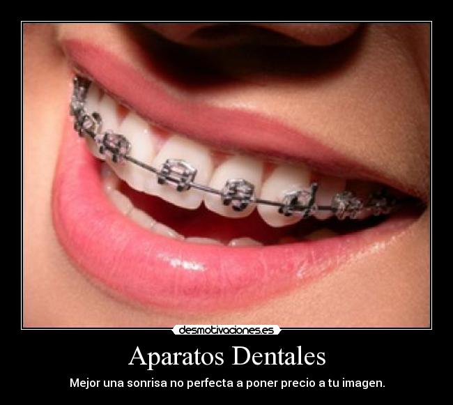 Aparatos Dentales -