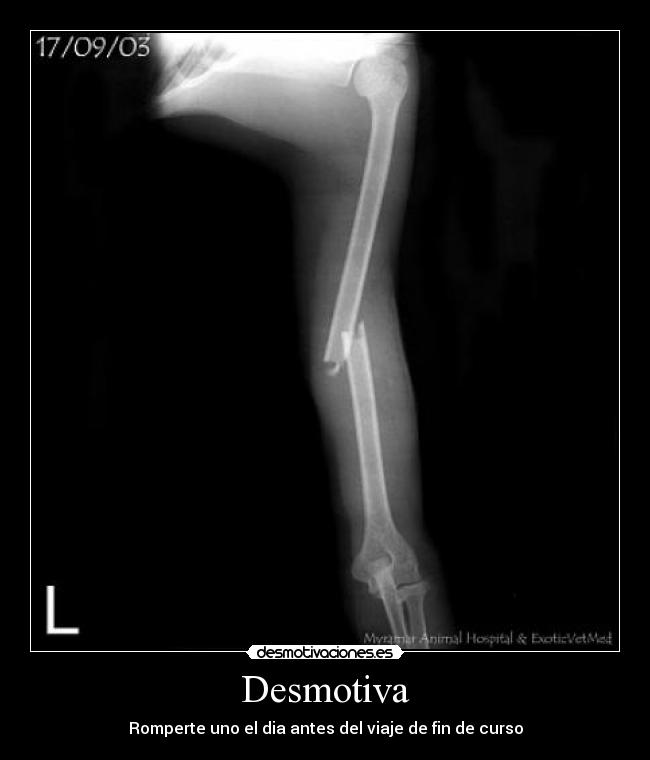 Desmotiva - Romperte uno el dia antes del viaje de fin de curso