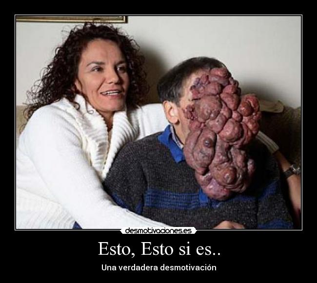 Esto, Esto si es.. - Una verdadera desmotivación