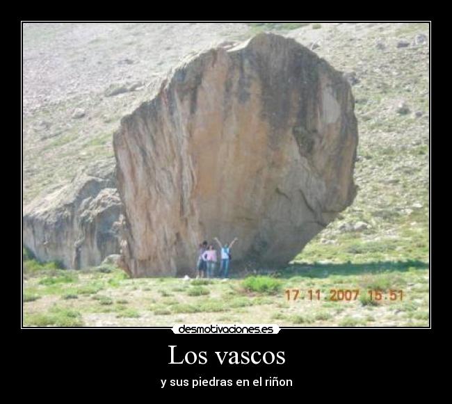 Los vascos - y sus piedras en el riñon