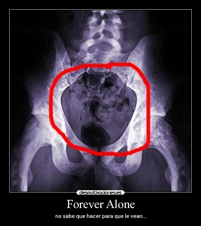 Forever Alone - no sabe que hacer para que le vean...
