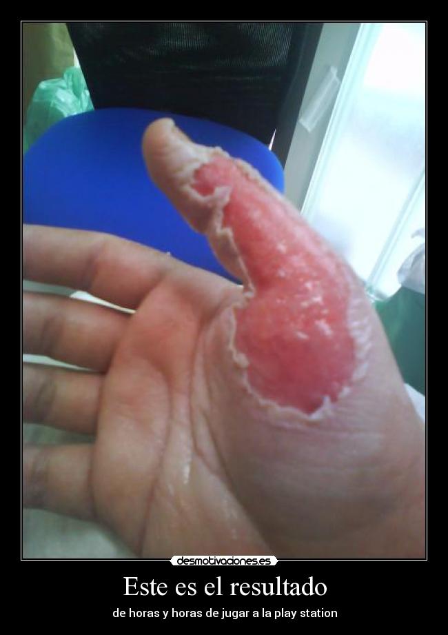 Este es el resultado - de horas y horas de jugar a la play station