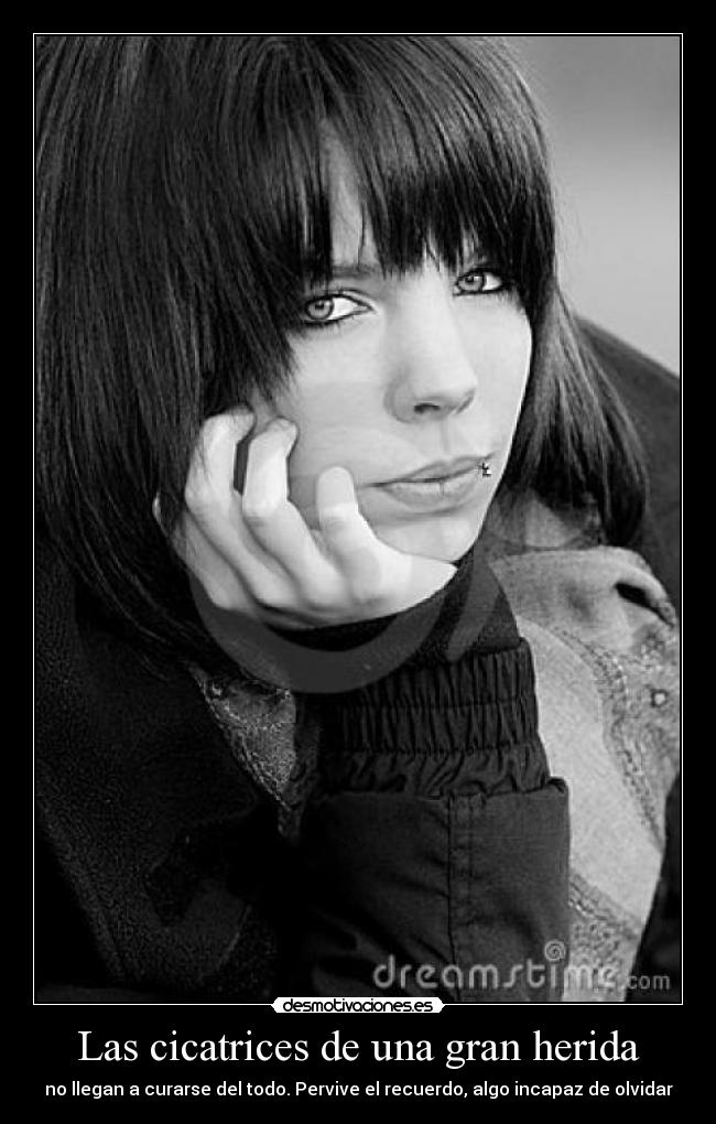 Las cicatrices de una gran herida - 