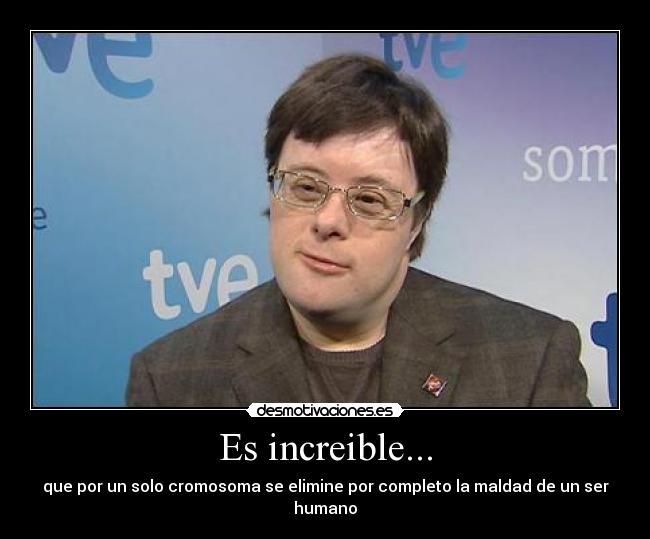 Es increible... - 