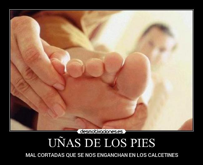 UÑAS DE LOS PIES -