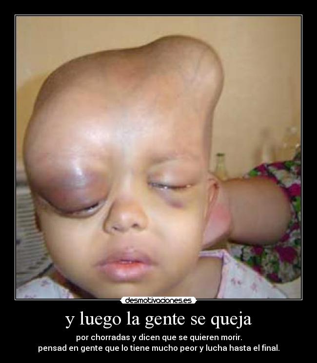y luego la gente se queja - por chorradas y dicen que se quieren morir.
pensad en gente que lo tiene mucho peor y lucha hasta el final.