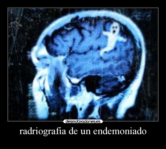 radriografia de un endemoniado -
