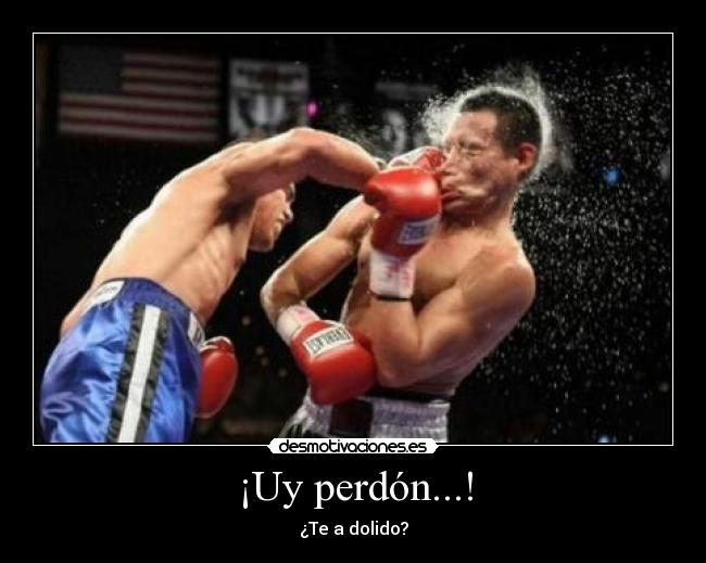 ¡Uy perdón...! - ¿Te a dolido?