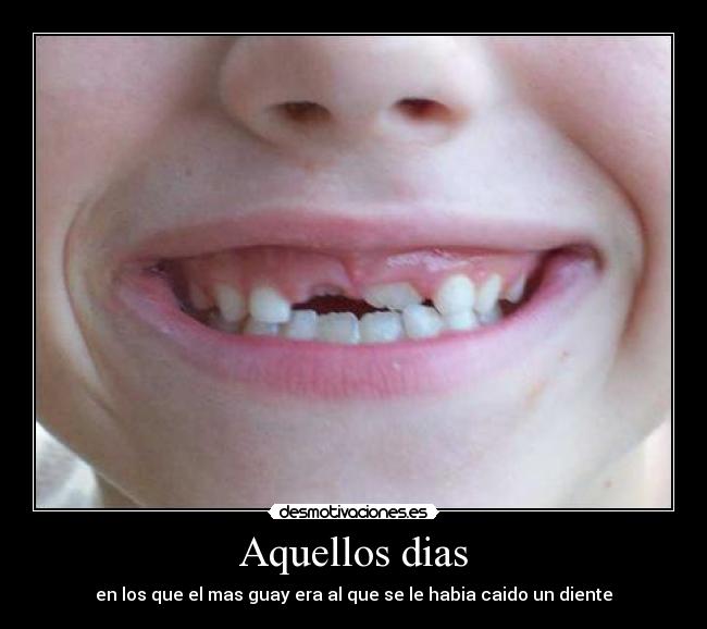 Aquellos dias - en los que el mas guay era al que se le habia caido un diente