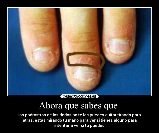 Ahora que sabes que -