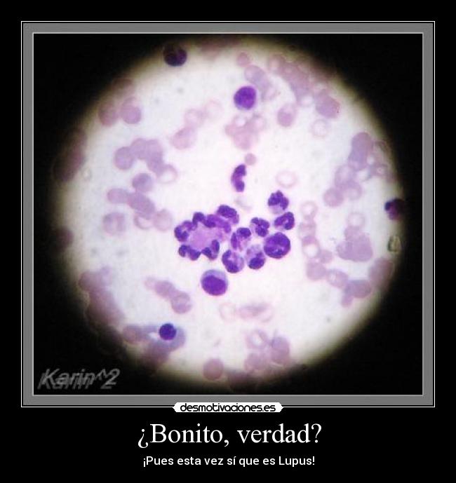 ¿Bonito, verdad? - ¡Pues esta vez sí que es Lupus!