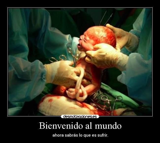 Bienvenido al mundo - 